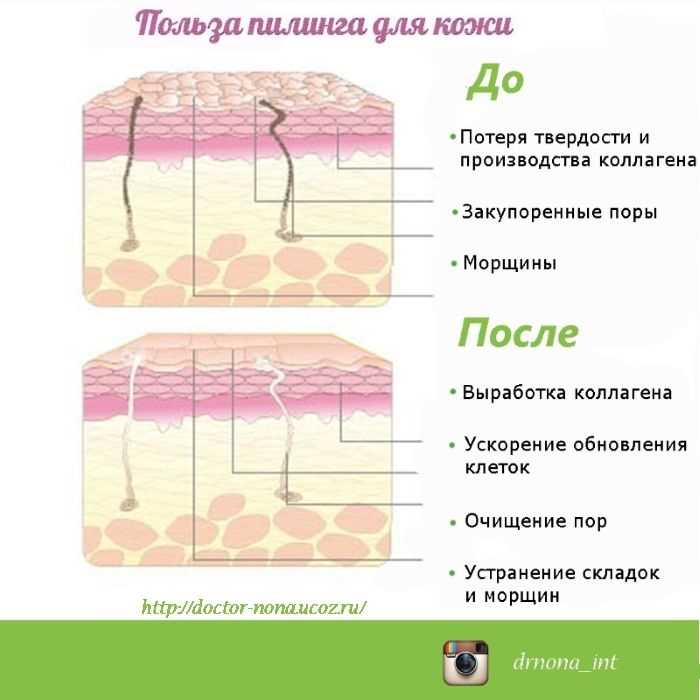 Чем отличается пилинг от скраба и что лучше для кожи Чем отличается пилинг от скраба и что лучше для кожи