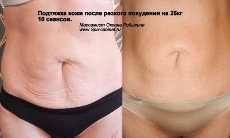 Процедуры, которые действительно работают (и те, от которых лучше держаться подальше)