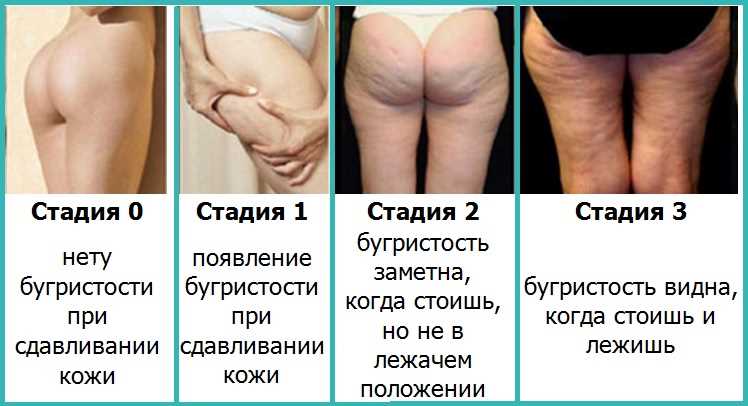 Что на самом деле происходит с нашим покровом, когда он теряет упругость