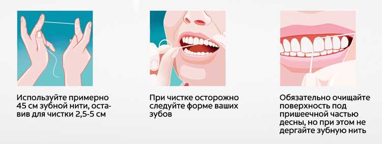 Как правильно чистить зубы щёткой, ирригатором и зубной нитью Как правильно чистить зубы щёткой, ирригатором и зубной нитью